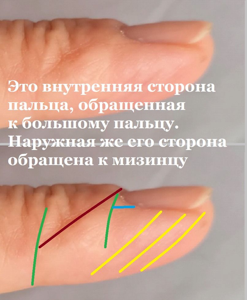 Эластизация околоногтевой зоны 2.jpg