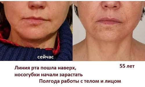 Как выровнять нос.jpg